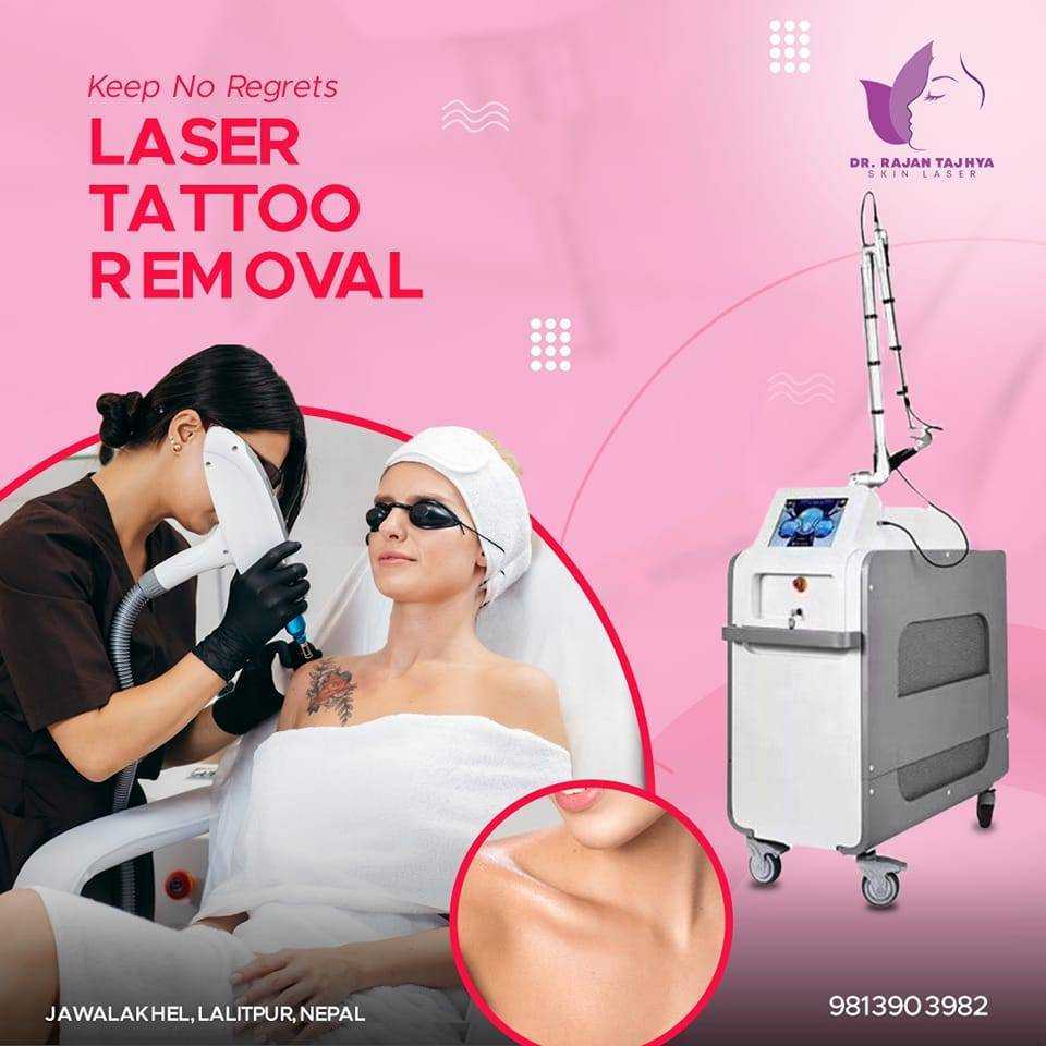 Laser tattoo removal in nepal - Dr.Rajan Tajhya | Aakar Dermatology