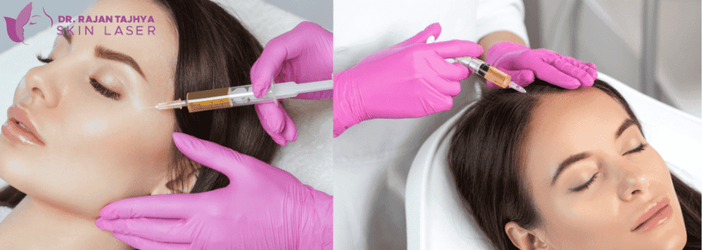 PRP Therapy